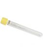 Provrör VACUETTE Gul Urin 7/6,5ml 50/FP