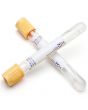 Hemogardrör SST gul 7/5ml 100/FP
